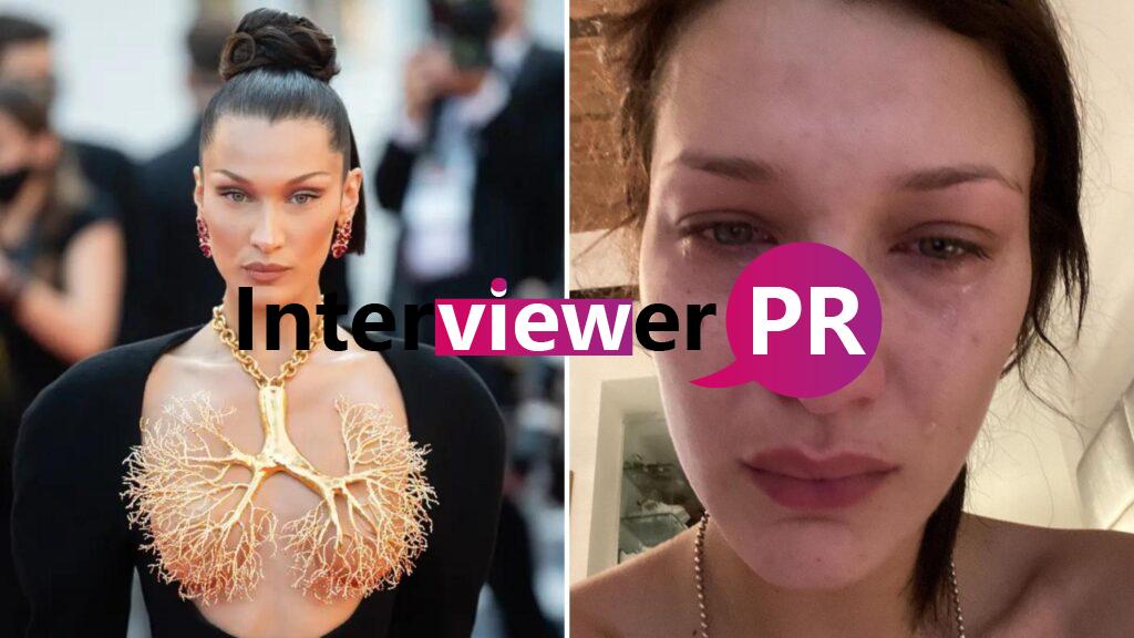 Bella Hadid Opens Up About her Mental Health Condition Says “You Are Not Alone”