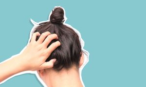 dry scalp causes