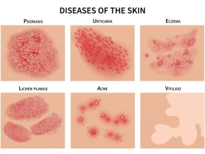 skin disorders chart