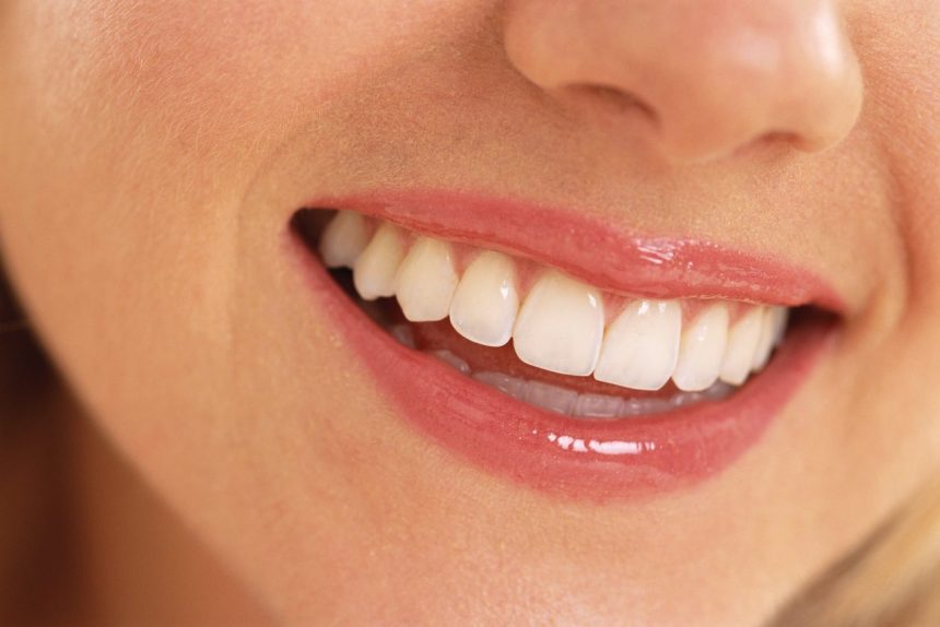 Want to Gain Confident Smile? Remove Wrinkles Around the Mouth