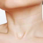 Treatments to Get Rid of Neck Lines and Wrinkles