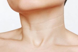 Treatments to Get Rid of Neck Lines and Wrinkles