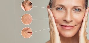 wrinkles acne skincare active ingredients
